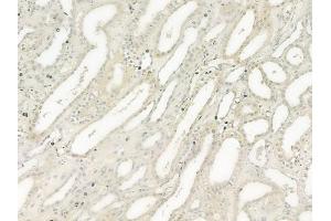 ABIN6259777 and ABIN6277561 at 1/100 staining human normal kidney tissue by IHC-P.