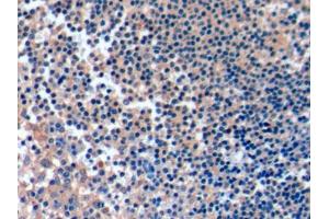 DAB staining on IHC-P; Samples: Human Tonsil Tissue (ICOSLG anticorps  (AA 23-249))