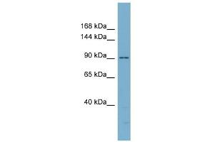 WB Suggested Anti-CTNND1 Antibody Titration: 0. (CTNND1 anticorps  (N-Term))