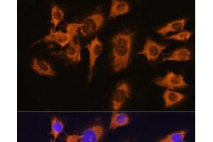 Immunofluorescence analysis of C6 cells using SLC20A1 Polyclonal Antibody at dilution of 1:100. (SLC20A1 anticorps)