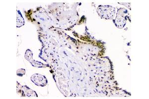 IHC analysis of HAUSP/USP7 using anti-HAUSP/USP7 antibody (ABIN6719603). (USP7 anticorps  (AA 258-483))
