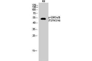 Western Blotting (WB) image for anti-Glycogen Synthase Kinase 3 alpha/beta (GSK3a/b) (pTyr216), (pTyr279) antibody (ABIN3179444) (GSK3 alpha/beta anticorps  (pTyr216, pTyr279))