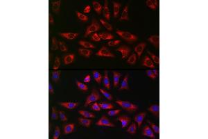 Immunofluorescence analysis of U2OS cells using GLB1 Rabbit pAb (ABIN3015642, ABIN3015643, ABIN3015644 and ABIN6218995) at dilution of 1:150 (40x lens). (GLB1 anticorps  (AA 1-270))