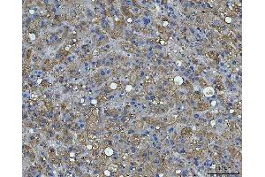 IHC analysis of BI-1/TMBIM6 using anti-BI-1/TMBIM6 antibody (ABIN7603199).