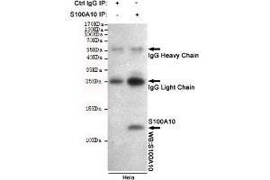 Immunoprecipitation analysis of Hela cell lysates using S100A10 mouse mAb. (S100A10 anticorps)