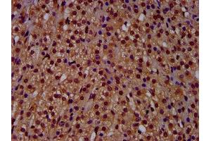 IHC image of ABIN7144968 diluted at 1:500 and staining in paraffin-embedded human adrenal gland tissue performed on a Leica BondTM system. (RECQL4 anticorps  (AA 200-337))
