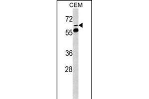 Western blot analysis of FKBP10 Antibody (N-term) (ABIN391572 and ABIN2841509) in CEM cell line lysates (35 μg/lane). (FKBP10 anticorps  (AA 57-87))