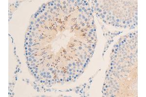 ABIN6267219 at 1/100 staining rat testicular tissue sections by IHC-P.