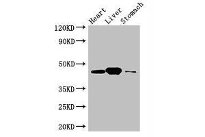 Western Blot Positive WB detected in: Mouse heart tissue, Mouse liver tissue, Mouse stomach tissue All lanes: LANCL1 antibody at 3 μg/mL Secondary Goat polyclonal to rabbit IgG at 1/50000 dilution Predicted band size: 46 kDa Observed band size: 46 kDa