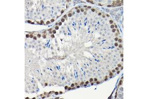 Immunohistochemistry of paraffin-embedded human placenta using Integrin alpha V (ITGAV/CD51) Rabbit mAb (ABIN7267922) at dilution of 1:100 (40x lens).