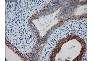 Image no. 12 for anti-Keratin 18 (KRT18) (AA 69-372) antibody (ABIN1491637)