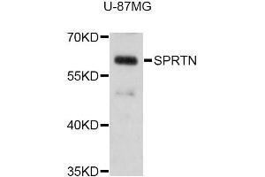 Western blot analysis of extracts of U-87MG cells, using SPRTN Antibody (ABIN5998940) at 1:3000 dilution. (Spartan anticorps)