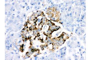 Anti- BAG2 Picoband antibody,IHC(P) IHC(P): Human Pancreatic Cancer Tissue