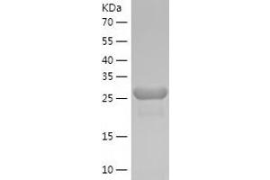Western Blotting (WB) image for Eyes Absent Homolog 2 (Drosophila) (EYA2) (AA 244-514) protein (His tag) (ABIN7122868) (EYA2 Protein (AA 244-514) (His tag))