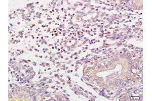 Formalin-fixed and human endometrium tissue labeled with Anti-NCF1/p47 phox Polyclonal Antibody, Unconjugated  at 1:100 followed by conjugation to the secondary antibody and DAB staining
