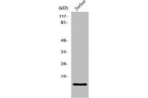Western Blot analysis of Jurkat cells using PHLDA3 Polyclonal Antibody