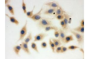 ICC testing of FFPE human A549 cells with FASN antibody. (Fatty Acid Synthase anticorps  (AA 1-226))