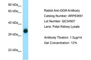 Western Blotting (WB) image for anti-gamma-Glutamyl Hydrolase (Conjugase, Folylpolygammaglutamyl Hydrolase) (GGH) (C-Term) antibody (ABIN2789590) (GGH anticorps  (C-Term))