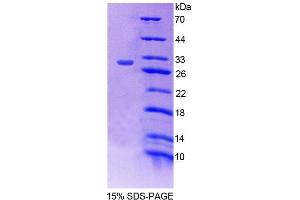 SDS-PAGE analysis of Mouse PCCb Protein. (PCCB Protéine)