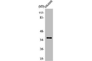 Western Blot analysis of HeLa cells using Olfactory receptor 52E5 Polyclonal Antibody