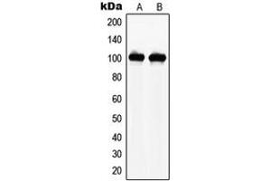 Western blot analysis of NAA15 expression in THP1 (A), HEK293 (B) whole cell lysates. (NAA15 anticorps  (Center))