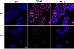 Immunocytochemical staining of HeLa cells using C1QBP antibody (ABIN7798136), 1:1,000), Top panel: wild-type (WT), Bottom panal: C1QBP shRNA knockdown (KD). (Recombinant C1QBP anticorps)