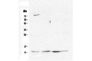 Western blot analysis of Cytochrome C using anti-Cytochrome C antibody (ABIN5693008). (Cytochrome C anticorps  (AA 2-105))