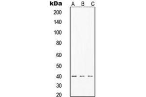 Western blot analysis of TIN2 expression in MCF7 (A), HeLa (B), Jurkat (C) whole cell lysates. (TINF2 anticorps  (Center))