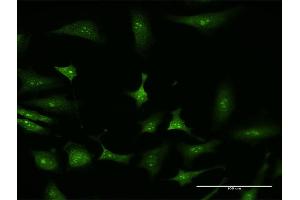 Immunofluorescence of monoclonal antibody to NFKBIA on HeLa cell.