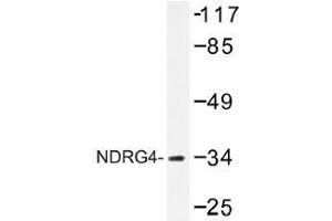 Image no. 1 for anti-NDRG Family Member 4 (NDRG4) antibody (ABIN317933) (NDRG4 anticorps)