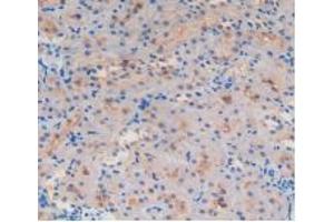 Figure. (GSTA4 anticorps  (AA 2-222))