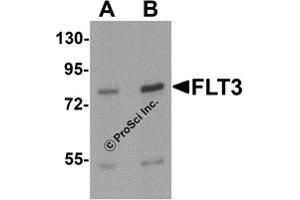Western Blotting (WB) image for anti-Fms-Related tyrosine Kinase 3 (FLT3) (N-Term) antibody (ABIN1077372) (FLT3 anticorps  (N-Term))
