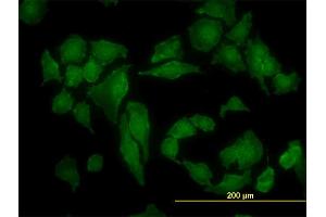 Immunofluorescence of monoclonal antibody to CSNK2A1 on HeLa cell.
