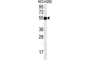 Western Blotting (WB) image for anti-Zinc Finger Protein 492 (ZNF492) antibody (ABIN2995742)