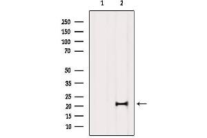 Western blot analysis of extracts from Mouse brain, using MED29 Antibody.