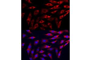 Immunofluorescence analysis of C6 cells using GAMT Rabbit pAb (ABIN6130447, ABIN6140950, ABIN6140951 and ABIN6222280) at dilution of 1:200 (40x lens).