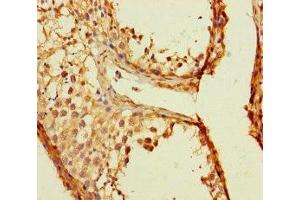 Immunohistochemistry of paraffin-embedded human testis tissue using ABIN7173143 at dilution of 1:100 (TMEM213 anticorps  (AA 30-60))
