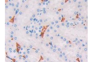 Used in DAB staining on fromalin fixed paraffin- embedded kidney tissue (UCP2 anticorps  (AA 99-216))