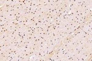 Immunohistochemistry analysis of paraffin-embedded rat heart using,SUN2 (ABIN7075502) at dilution of 1: 4000 (SUN2 anticorps)