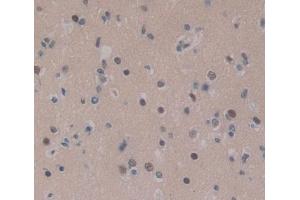 Used in DAB staining on fromalin fixed paraffin- embedded brain tissue (CEBPD anticorps  (AA 51-252))
