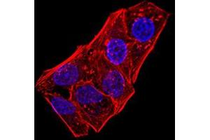 Immunofluorescence analysis of Hela cells using ATG5 mouse mAb. (ATG5 anticorps  (AA 144-275))