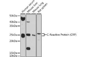 Western blot analysis of extracts of various cell lines, using C-Reactive Protein (C-Reactive Protein (CRP)) antibody (ABIN3020715, ABIN3020716, ABIN3020717 and ABIN6213688) at 1:1000 dilution. (CRP anticorps  (AA 1-224))