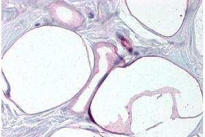 Human Breast, Adipocytes (formalin-fixed, paraffin-embedded) stained with FABP4 antibody ABIN790284 at 10 ug/ml followed by biotinylated goat anti-rabbit IgG secondary antibody ABIN481713, alkaline phosphatase-streptavidin and chromogen.