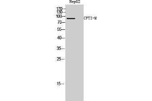 Western Blotting (WB) image for anti-Carnitine Palmitoyltransferase 1B (Muscle) (CPT1B) (Internal Region) antibody (ABIN3174542) (CPT1B anticorps  (Internal Region))
