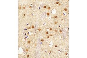 Immunohistochemical analysis of paraffin-embedded M.