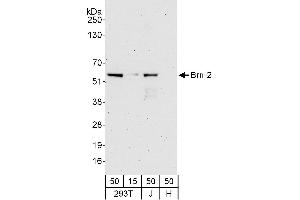 Western Blotting (WB) image for anti-POU Class 3 Homeobox 2 (POU3F2) (AA 393-443) antibody (ABIN7453048)