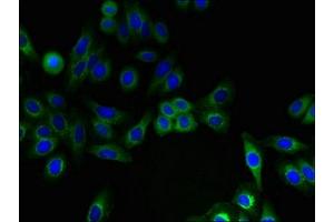 anti-Interferon Induced Transmembrane Protein 2 (IFITM2) (AA 1-56) antibody