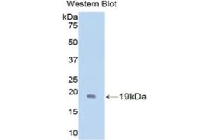 Detection of Recombinant GDNF, Mouse using Polyclonal Antibody to Glial Cell Line Derived Neurotrophic Factor (GDNF) (GDNF anticorps  (AA 79-217))