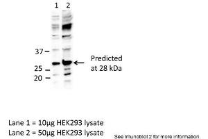 Sample Type: Lane1 = 10ug HEK293 lysateLane 2 = 50ug HEK293 lysatePrimary Antibody Dilution: Anti-EIF4E 1:1000Submitted By: Dr. (EIF4E anticorps  (C-Term))