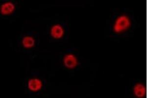 ABIN6275695 staining Hela by IF/ICC. (ZZZ3 anticorps  (Internal Region))